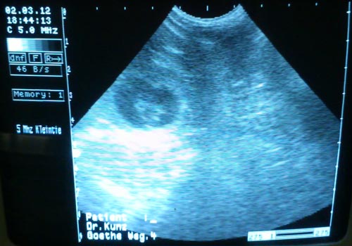 M-Wurf DW von der Huht Ultraschallbilder